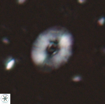 Calcidiscus parvicrucis 29035