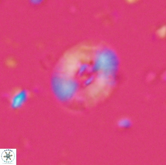 Calcidiscus parvicrucis 29037