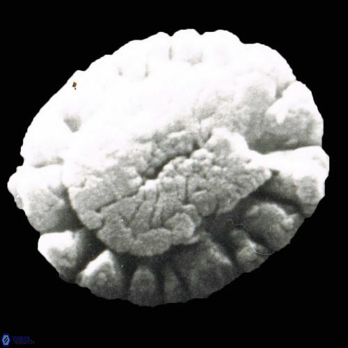 Calcidiscus pataecus 882 27