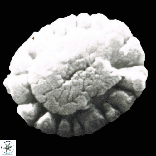 Calcidiscus pataecus 882 27