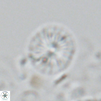 Calcidiscus pataecus VR 05105