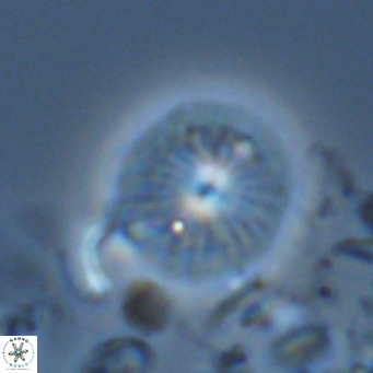 Calcidiscus pataecus VR 05107