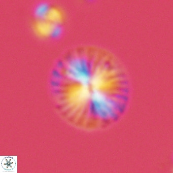 Calcidiscus pataecus VR 05842