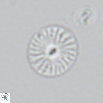 Calcidiscus pataecus VR 05849