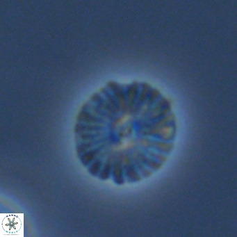 Calcidiscus pataecus VR 09407