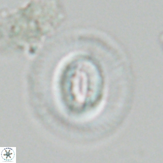 Calcidiscus premacintyrei 27514