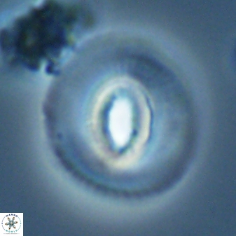 Calcidiscus premacintyrei 27515