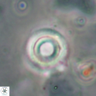 Calcidiscus salomonii 685