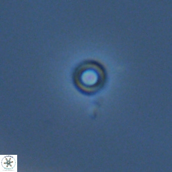 Calcidiscus salomonii VR 05822