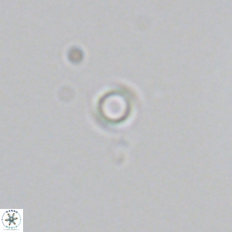 Calcidiscus salomonii VR 05823