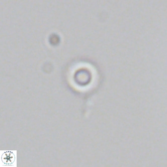 Calcidiscus salomonii VR 05824