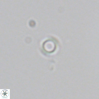 Calcidiscus salomonii VR 05825