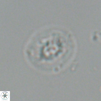 Calcidiscus sp C 24600
