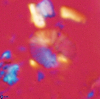 Calcidiscus sp 21027