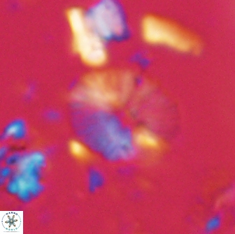 Calcidiscus sp 21027