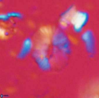 Calcidiscus sp 21028