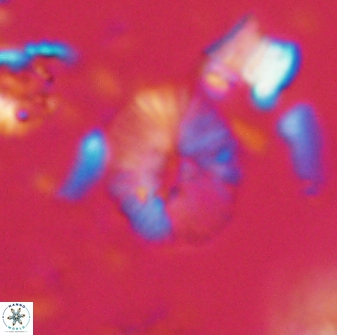 Calcidiscus sp 21028