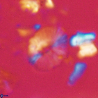 Calcidiscus sp 21031