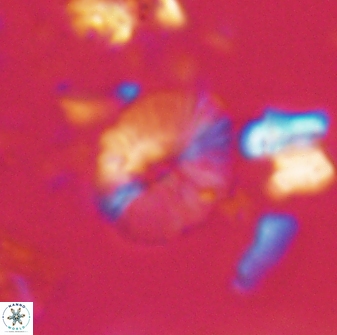 Calcidiscus sp 21031