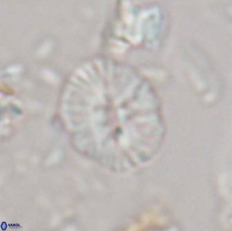 Calcidiscus sp 21032