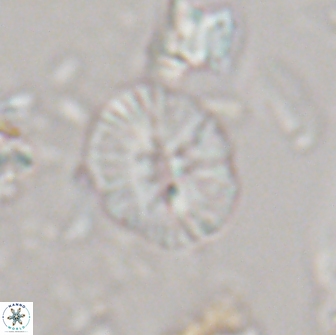 Calcidiscus sp 21032