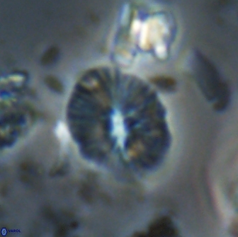 Calcidiscus sp 21033