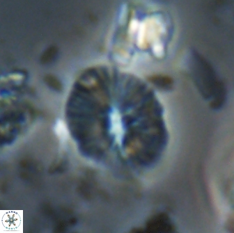 Calcidiscus sp 21033