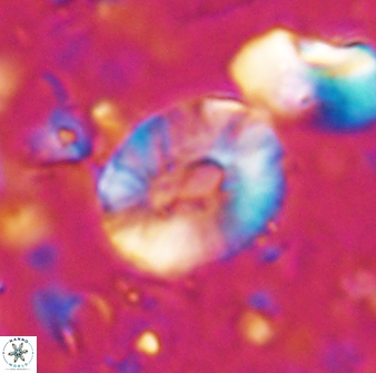 Calcidiscus sp 27946