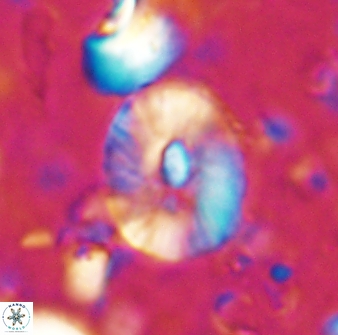 Calcidiscus sp 27947
