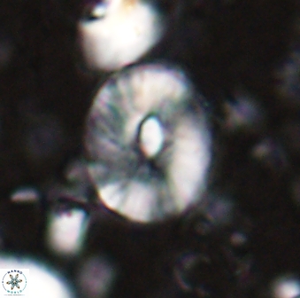 Calcidiscus sp 27949