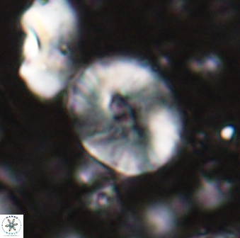 Calcidiscus sp 27950