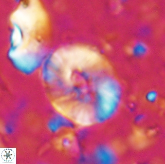 Calcidiscus sp 27951