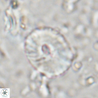 Calcidiscus sp 27952