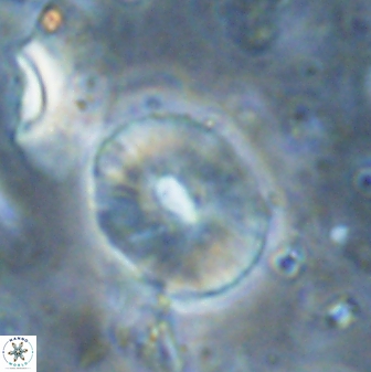 Calcidiscus sp 27953