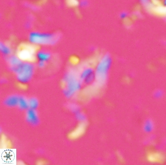 Calcidiscus sp 28975