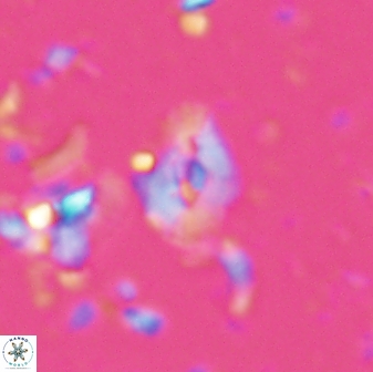 Calcidiscus sp 28977