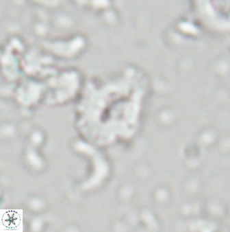 Calcidiscus sp 28984