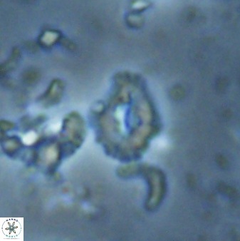 Calcidiscus sp 28986