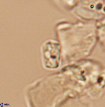 Calcivascularis cassedyi 11188