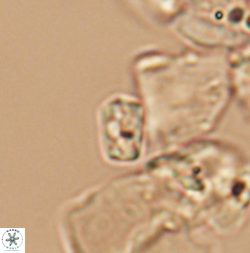 Calcivascularis cassedyi 11188
