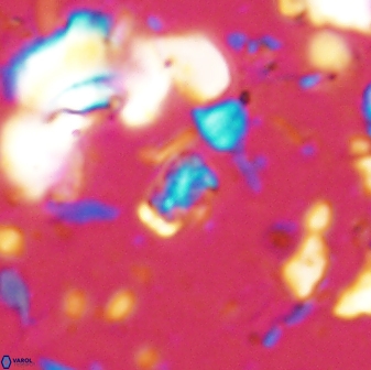 Calcivascularis cassedyi 33107