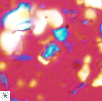 Calcivascularis cassedyi 33107