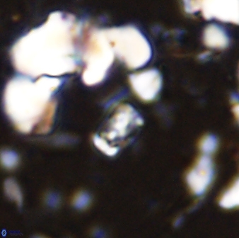 Calcivascularis cassedyi 33108