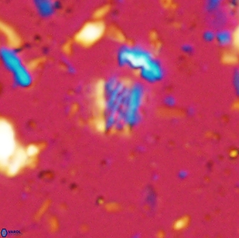 Calcivascularis cassedyi 33121