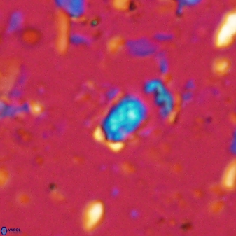 Calcivascularis cassedyi 33123