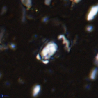 Calcivascularis cassedyi 33124