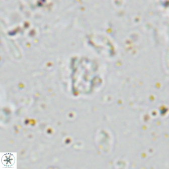 Calcivascularis cassedyi 33127