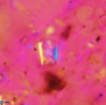 Calcivascularis cassidyi 1590