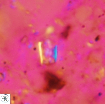 Calcivascularis cassidyi 1590