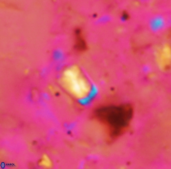 Calcivascularis cassidyi 1591